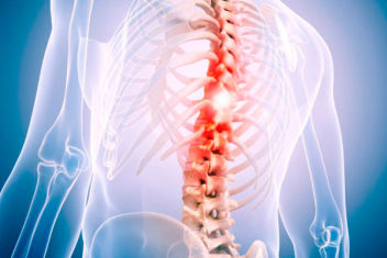 spinalsurgerymexico.com