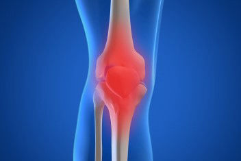 kneereplacementinmexico.com